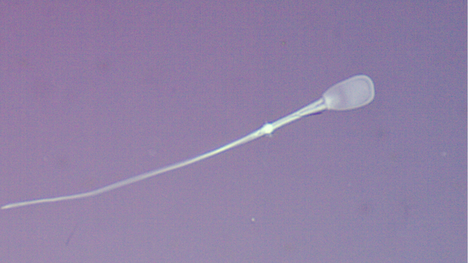 Double Tail Sperm