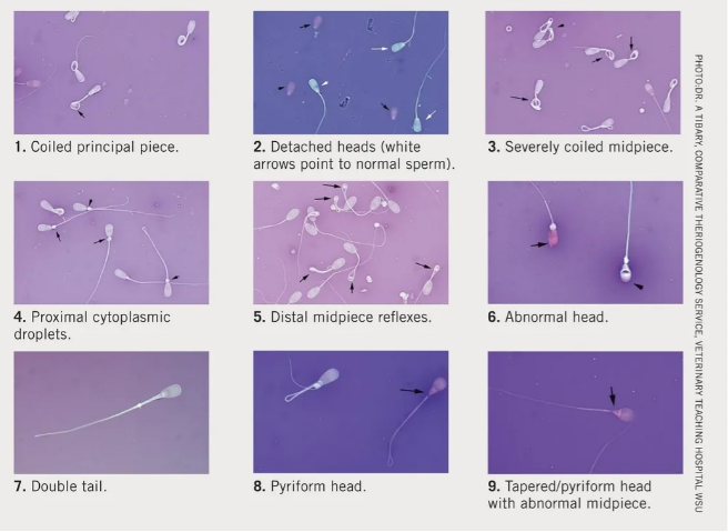 nine sperm abnormalities