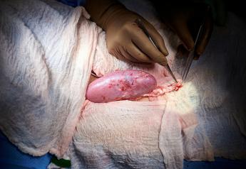 Surgeons Successfully Test Pig Kidney Transplant in Human Patient