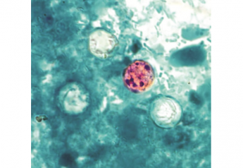 Texas County searching for Cyclospora infection source