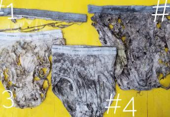 Underwear Measures Soil Microbial Activity