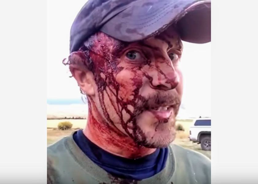 How much pain will a man endure to stay alive? On Oct. 1, 2016, Todd Orr answered the question in harrowing detail.