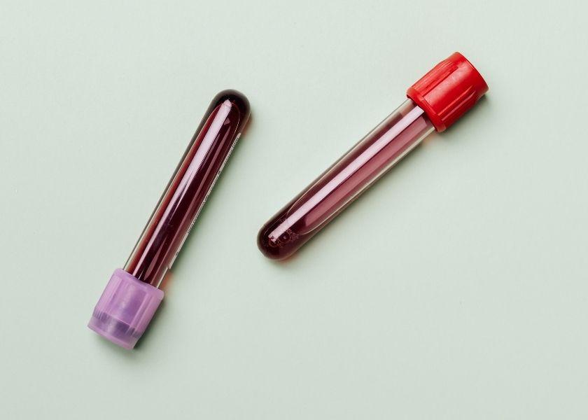 The cost of each test is $2.50. When equipment and shipping costs are added, the total expense per sample is about $3.22.