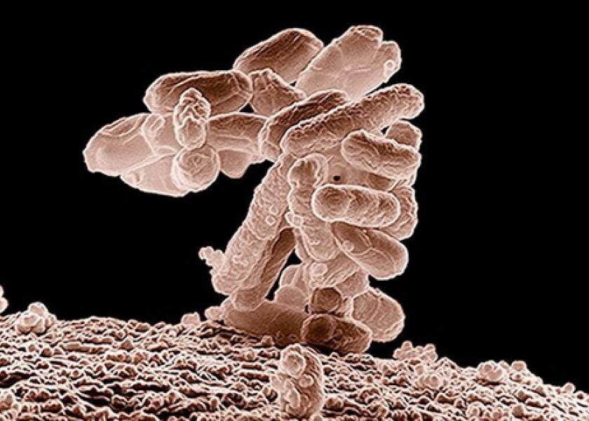 Low-temperature electron micrograph of a cluster of oblong-shaped E. coli bacteria.