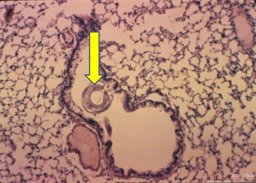 Larvae pointed out by an arrow of nematodes that cause verminous pneumonia in pigs including Ascaris. 