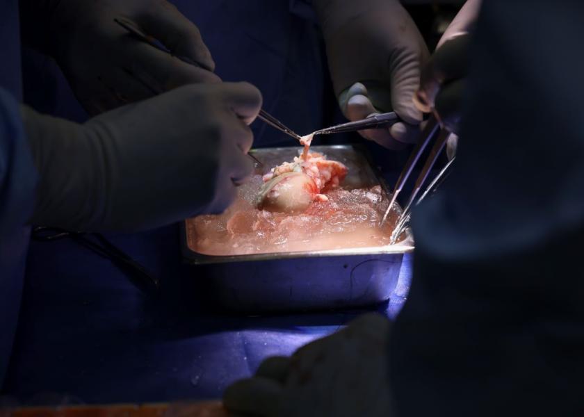 Surgeons prepare the pig kidney for transplantation.