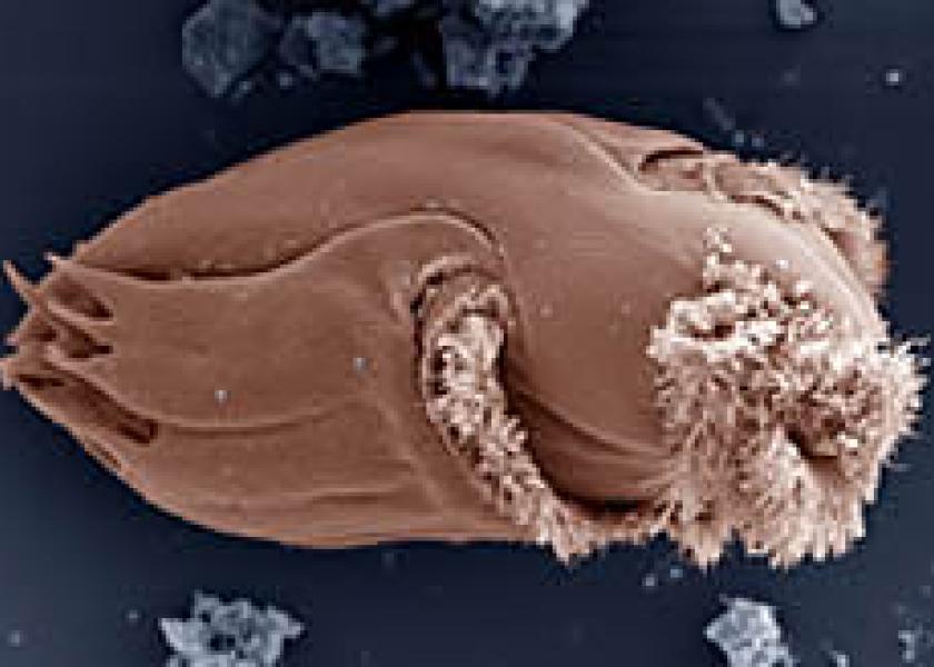 The protozoan Ophryoscolex spp. has a unique and complex cell structure. With an average length of 185 micrometers, it is one of the largest in the cow's rumen.