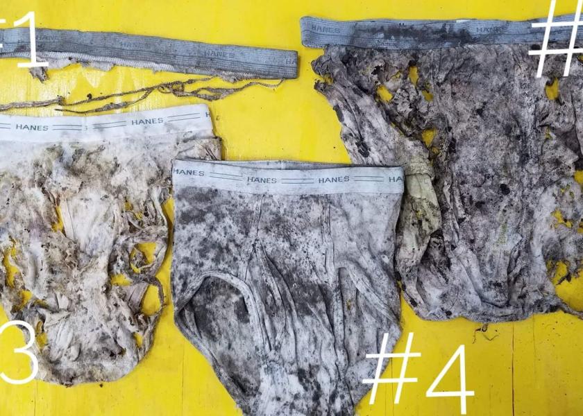 Underwear Measures Soil Microbial Activity AgWeb